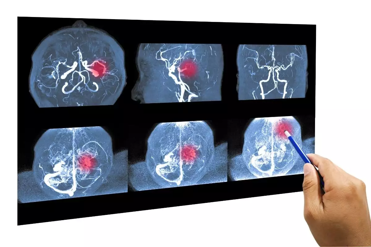 Falta de sono compromete funções cerebrais e acelera o envelhecimento