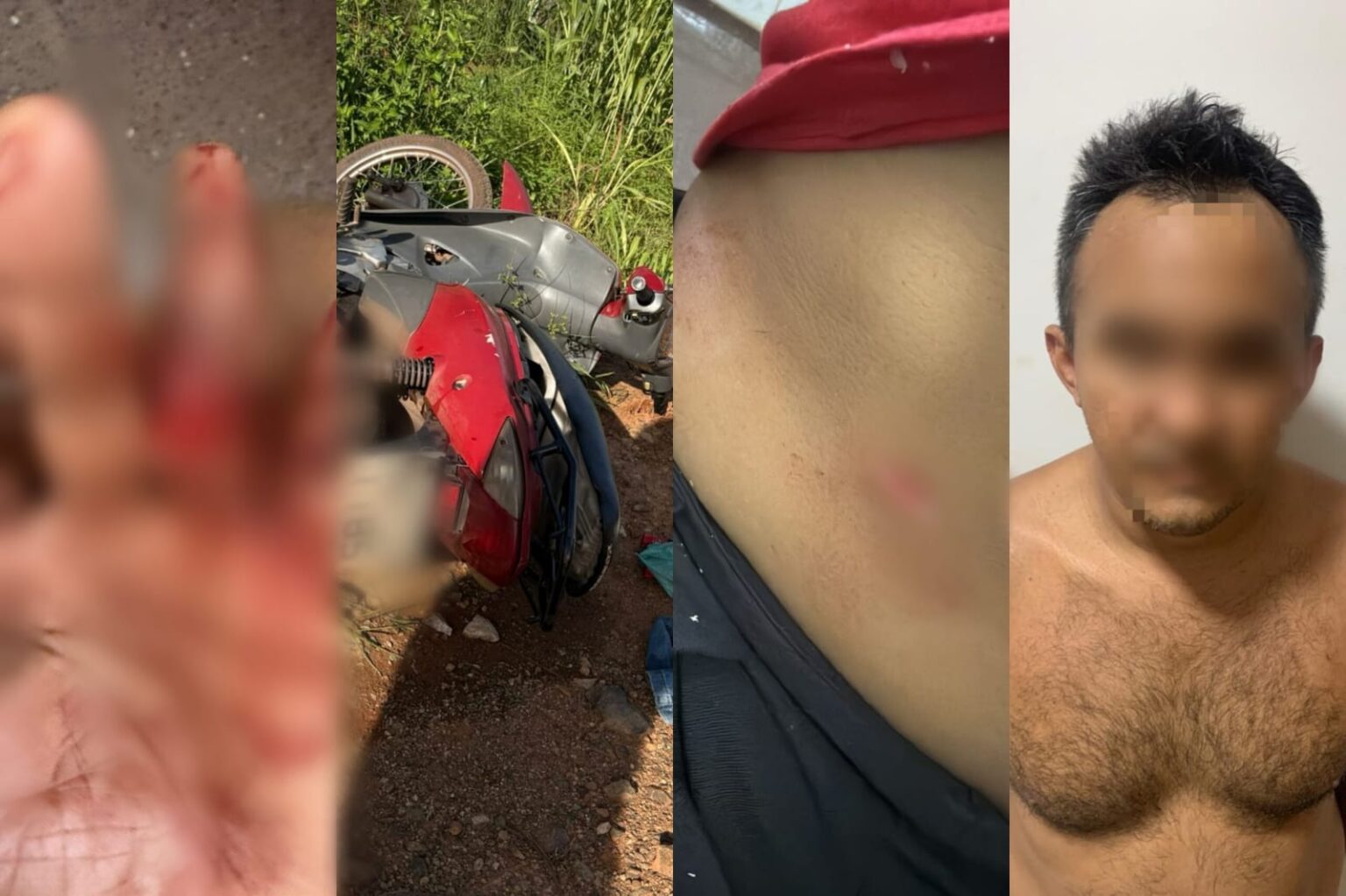 Homem não aceita separação e ataca ex-companheira com faca em Parauapebas