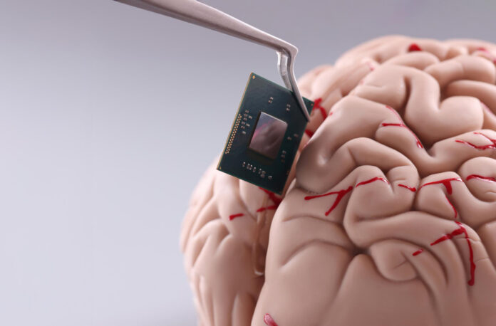 China aprova primeiro implante cerebral comercial