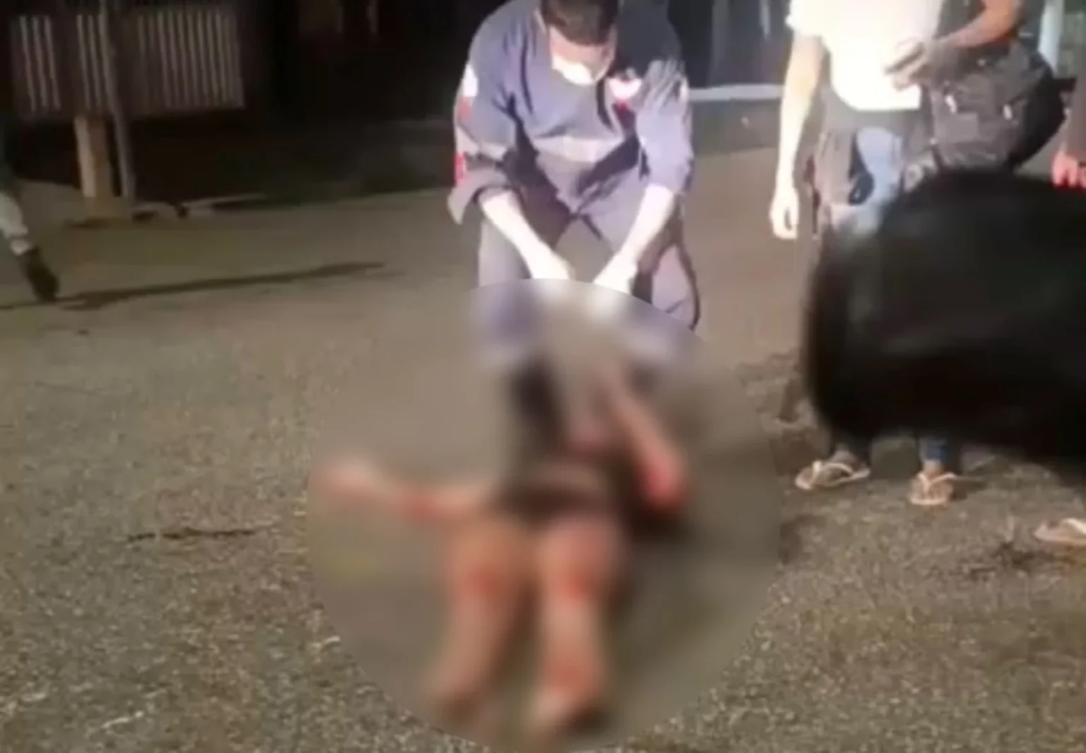 Mulher fica ferida após ser ‘atropelada’ por cachorro no Pará