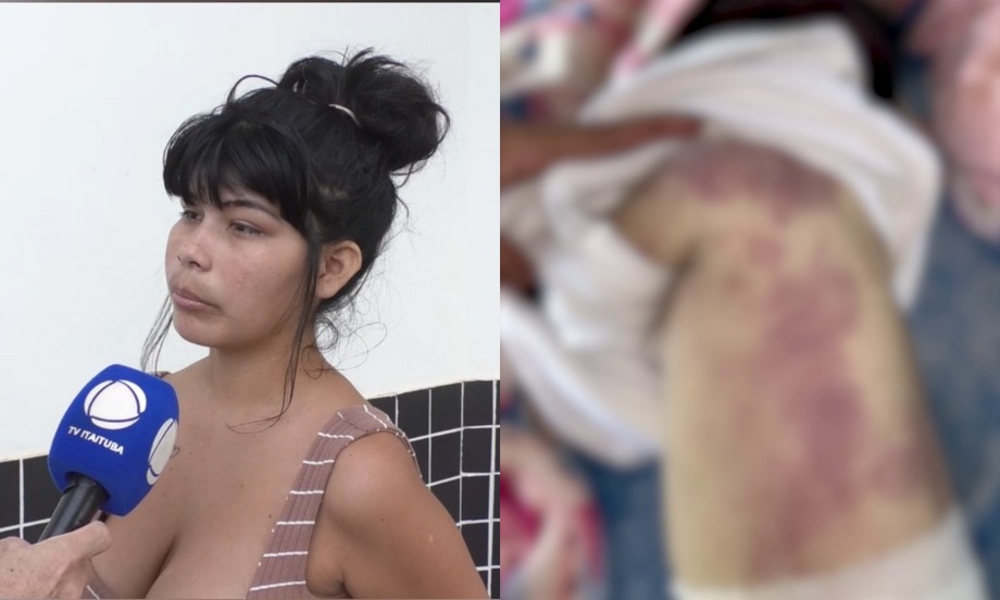 Bebê de 2 meses é encontrada morta com marcas pelo corpo em Itaituba