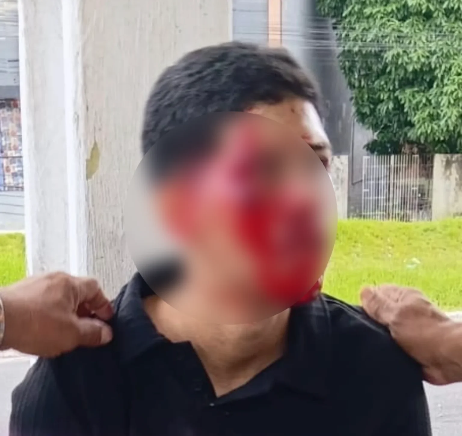 Sem capacete, jovem perde controle da moto e sofre acidente no Pará