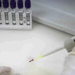 Rio Grande do Sul investiga caso suspeito de ebola