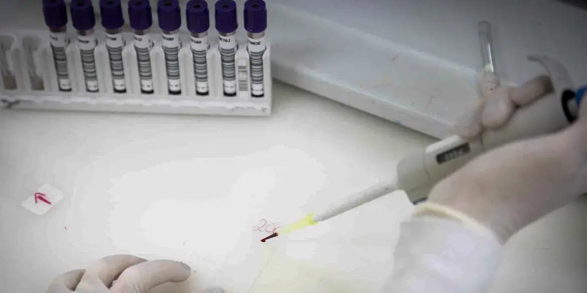 Rio Grande do Sul investiga caso suspeito de ebola