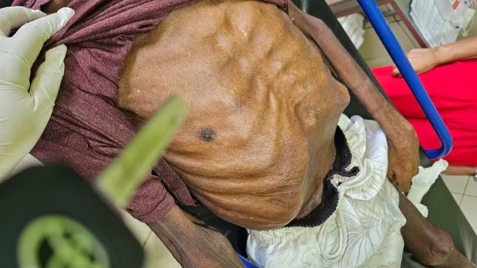 Filha é presa por maus-tratos após morte do pai com sinais de desnutrição em Ipixuna do Pará
