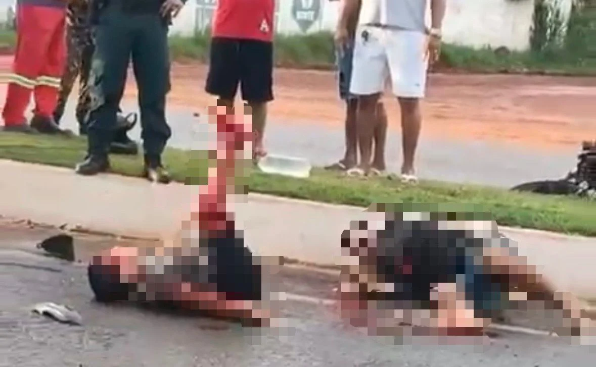 Acidente de moto deixa criança de 11 anos gravemente ferida no Pará