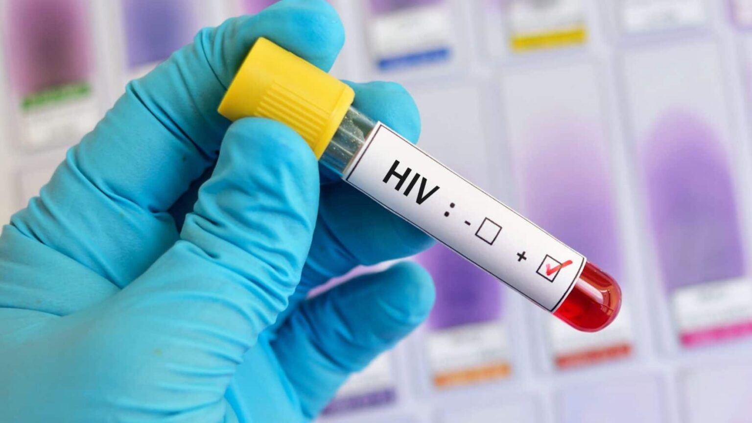 Marabá aparece em 2º lugar no ranking nacional de índice composto de HIV/Aids