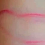 Mãe diz que filha de 4 anos foi agredida com fio de carregador, em Parauapebas