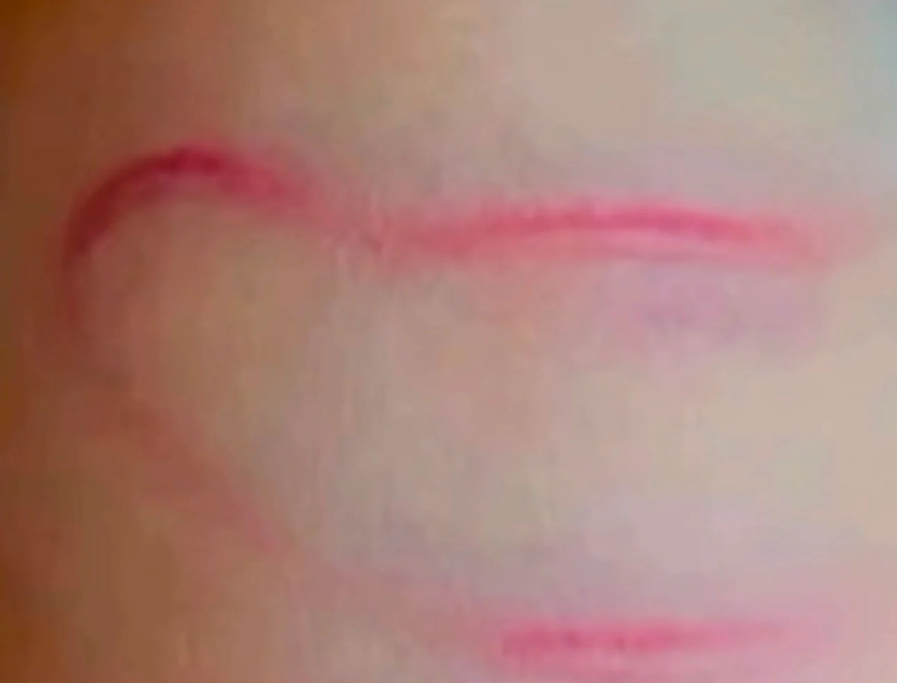 Mãe diz que filha de 4 anos foi agredida com fio de carregador, em Parauapebas
