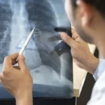 Tabagismo é maior entre jovens de 16 a 24 anos, alerta pesquisa