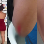 Briga entre três mulheres termina com uma uma ferida em bar de Novo Progresso