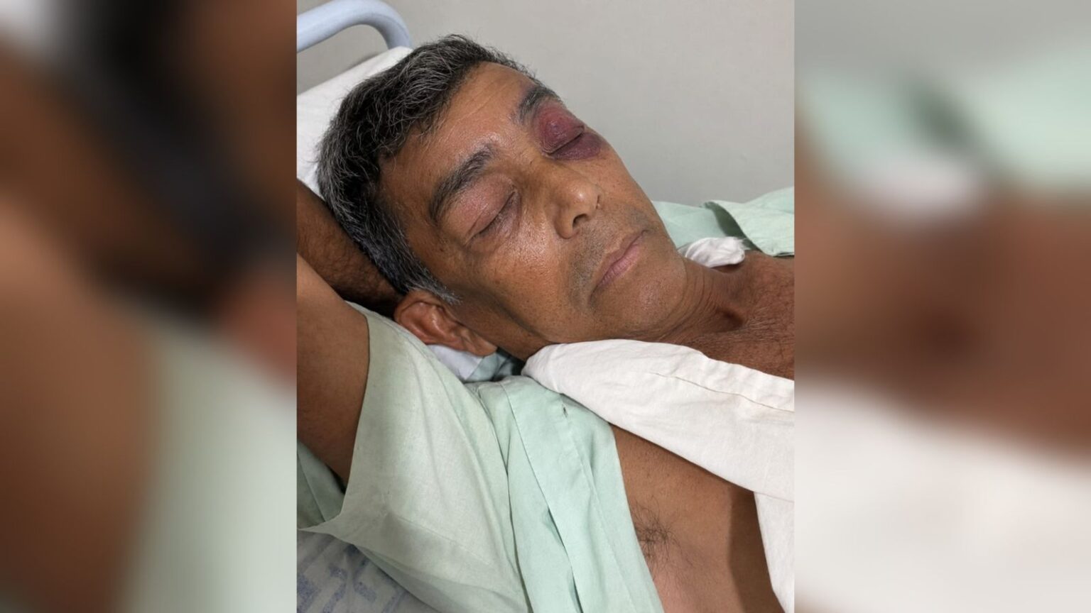 Idoso de 78 anos é agredido pelo próprio filho adolescente em Jacundá
