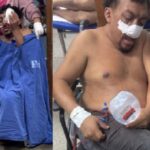 Massacre: “Odilonzinho” está em coma no HMM em Marabá