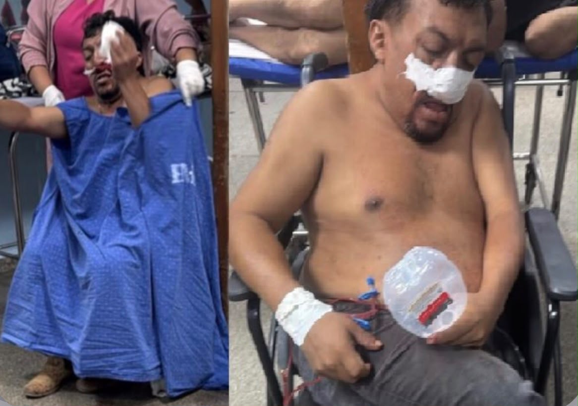 Massacre: “Odilonzinho” está em coma no HMM em Marabá