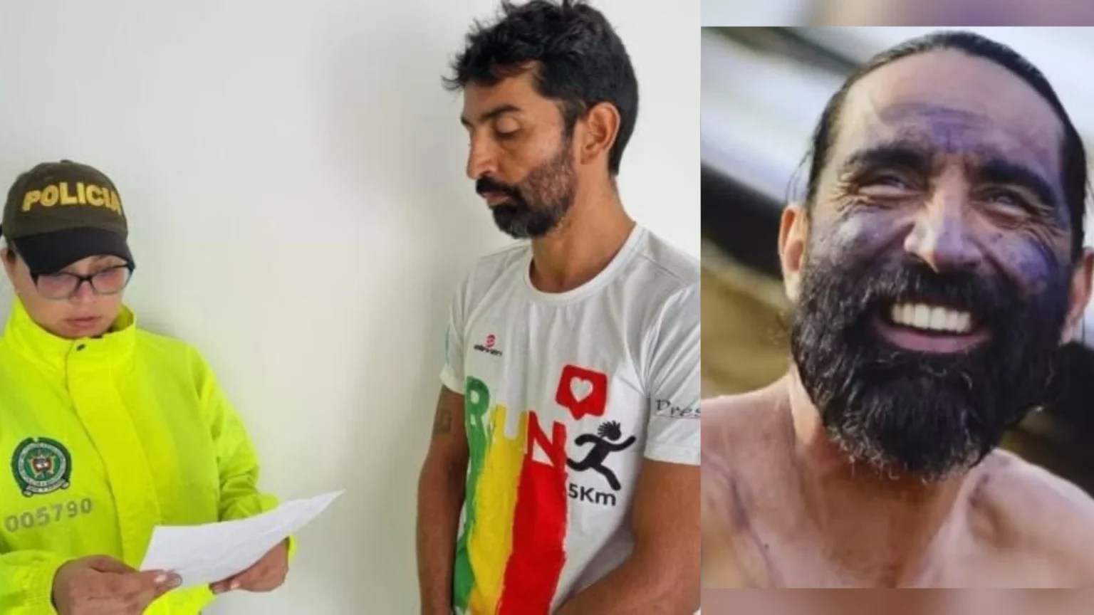 ‘Homem-peixe’ que está no Pará já foi preso por abuso sexual infantil, diz imprensa internacional
