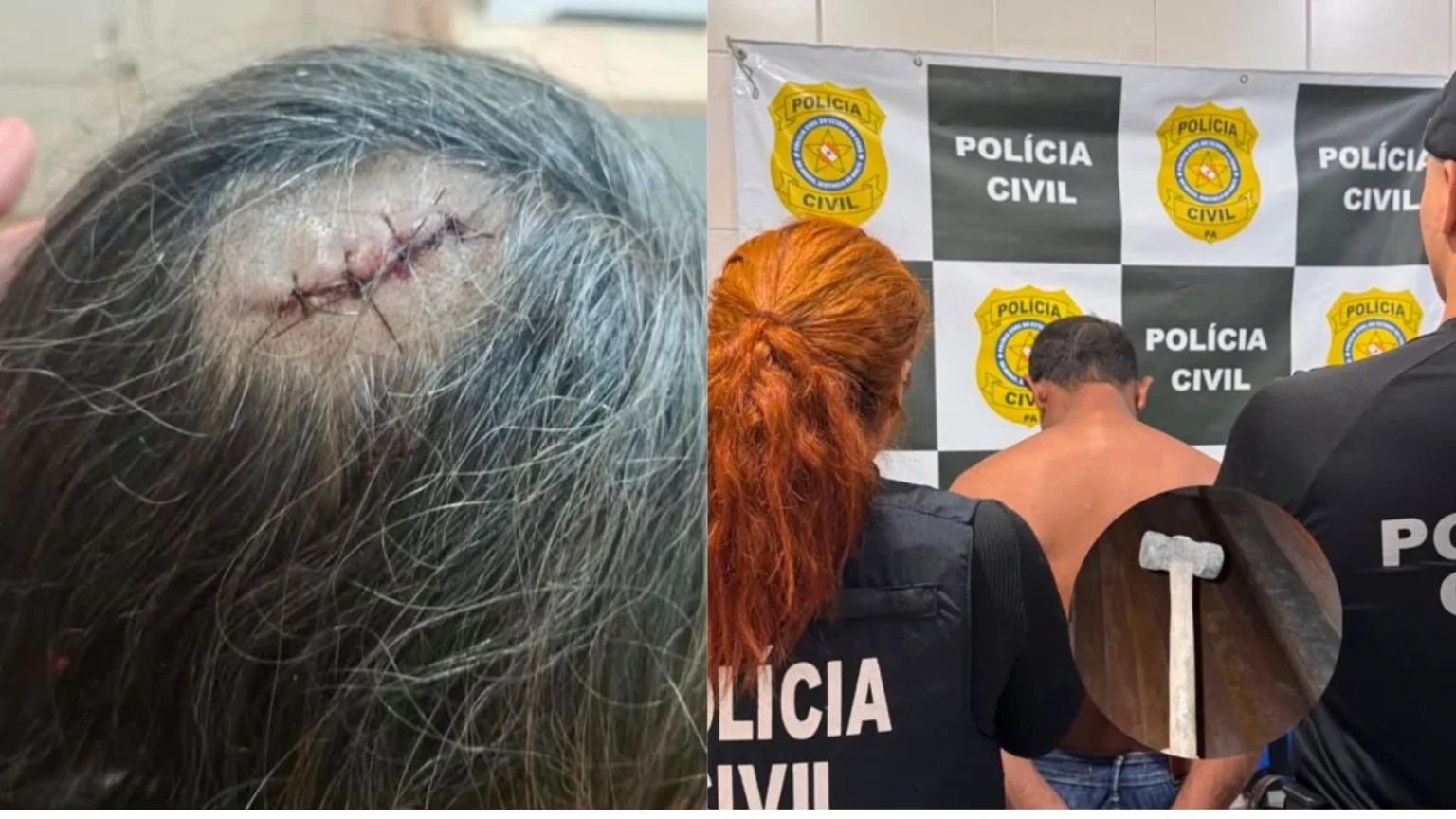 Filho é preso após atacar a mãe com marreta no nordeste do Pará