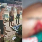Jovem leva 43 pontos após sobreviver a ataque com garrafa quebrada no Pará