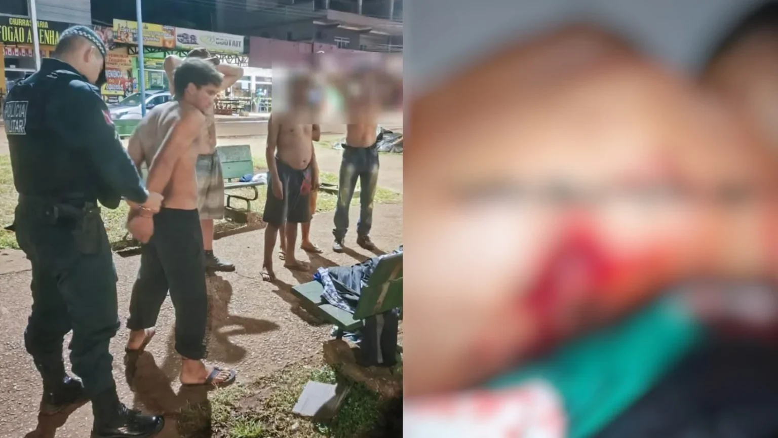 Jovem leva 43 pontos após sobreviver a ataque com garrafa quebrada no Pará