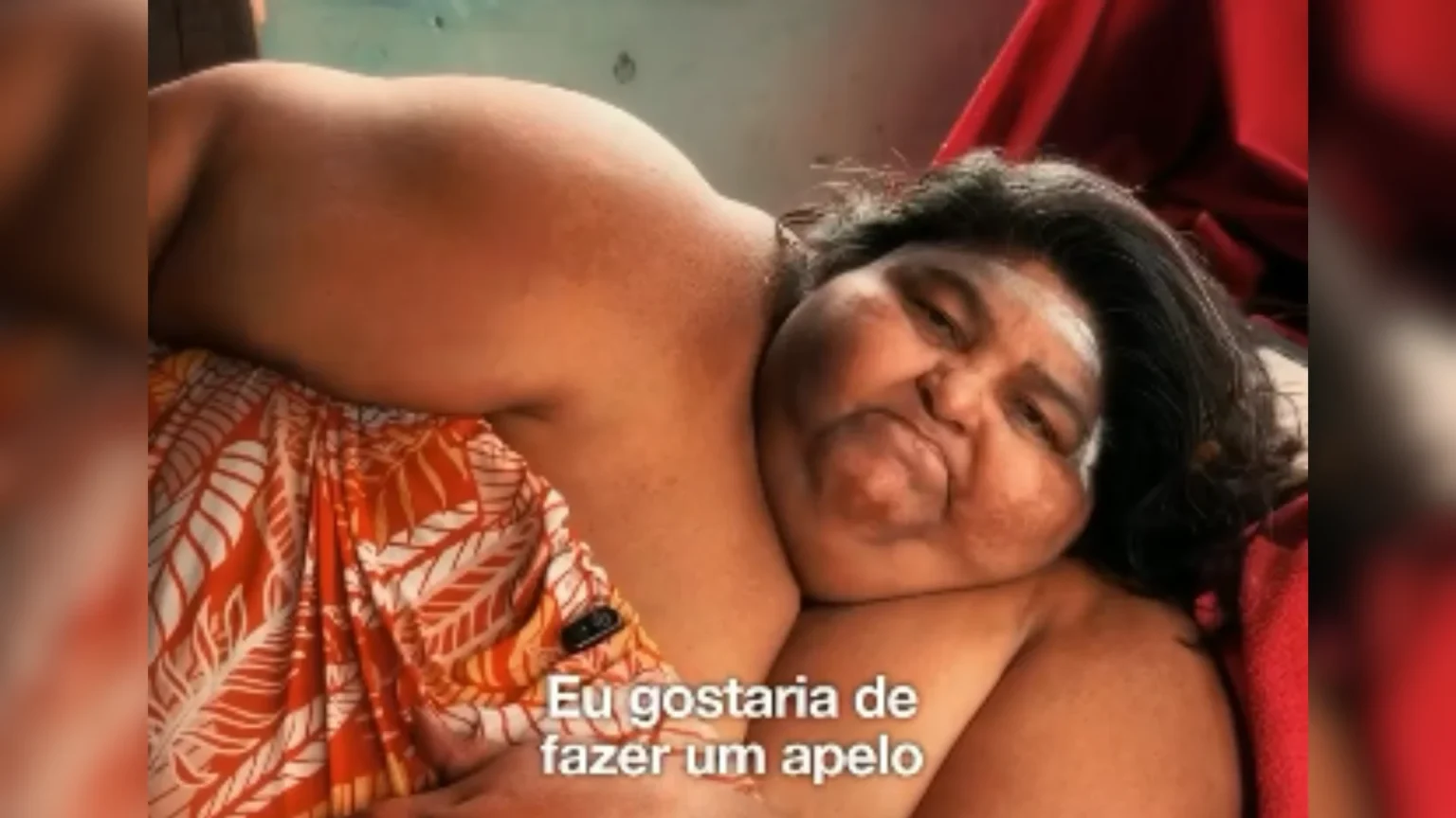 Mulher com 350 kg busca ajuda para retomar tratamento contra obesidade em Belém