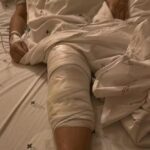 Mulher acorda após cirurgia no Paraná e percebe que médico implantou prótese no joelho errado