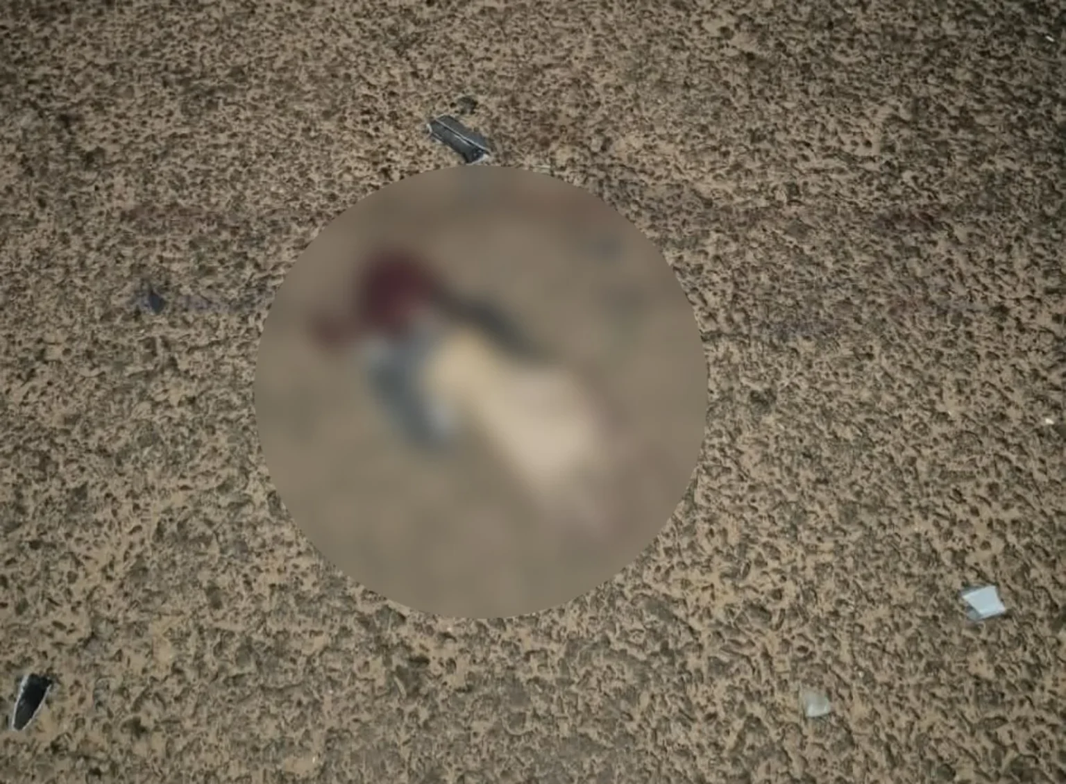Homem perde a mão em acidente grave no sudeste do Pará